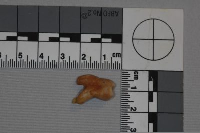 The forensic image of a dental evidence